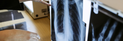 X-ray